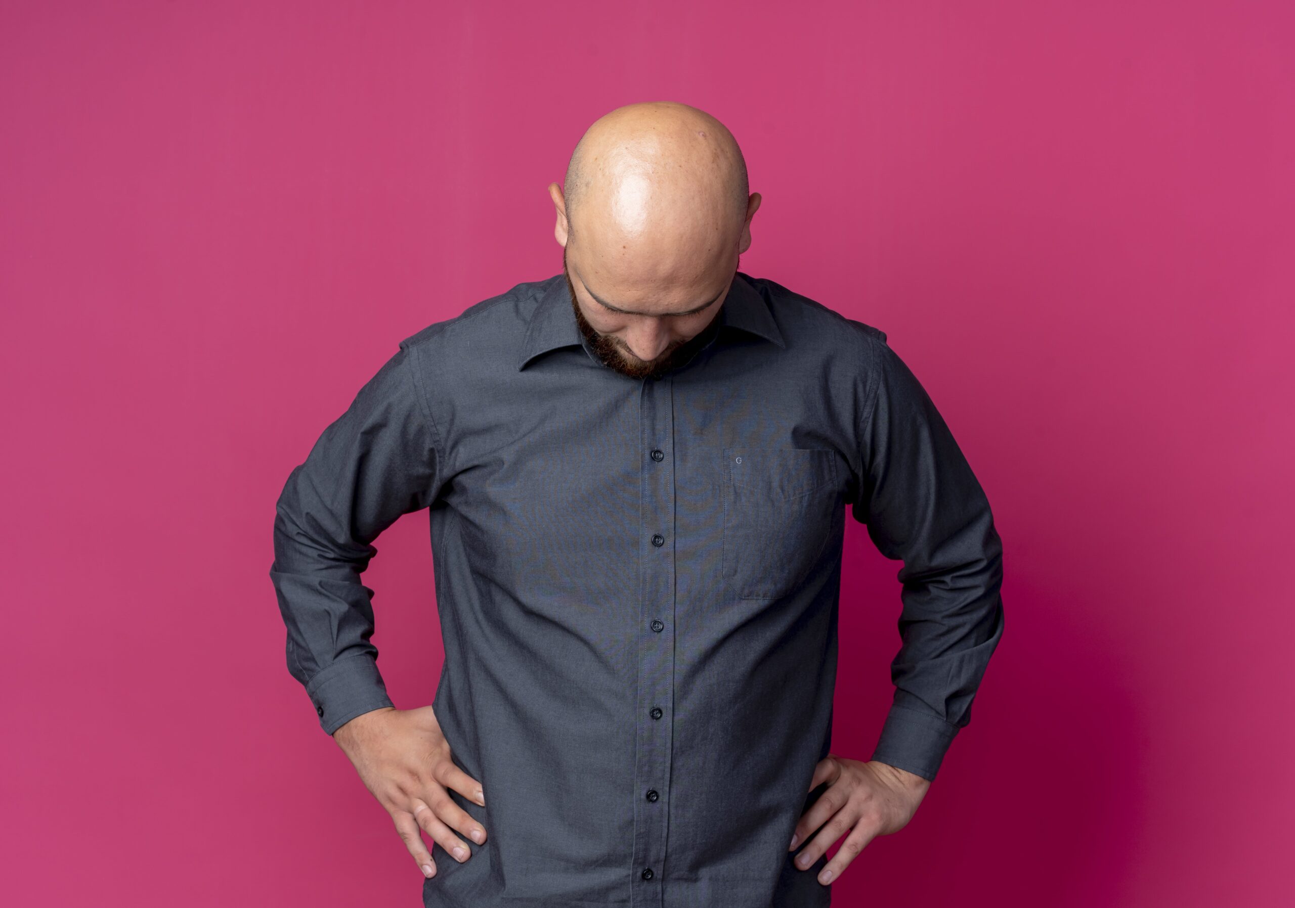 Przeszczep włosów w Turcji